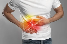 8 dấu hiệu sớm của gan nhiễm mỡ