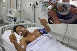 Cục Kiểm lâm nói về vụ mang rắn đến bệnh viện cấp cứu 