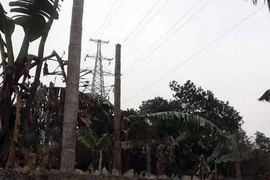 Mắc bóng đèn, bị điện cao thế giật cháy sém nửa người