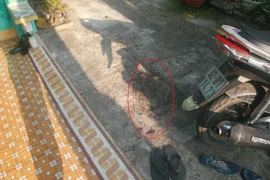 Bắn vào má người yêu rồi chở đi cấp cứu, xong... bỏ trốn 