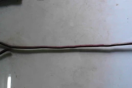 Cậu bé 11 tuổi bị thanh sắt 40cm đâm xuyên hậu môn