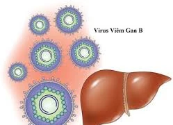 Việt Nam có tỉ lệ nhiễm viêm gan B cao trên thế giới