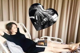 Từ Nhược Tuyên công khai ảnh siêu âm mang bầu bé trai