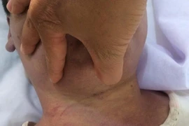 ​Học viên chết bất thường ở trung tâm cai nghiện