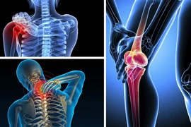 iBONE FiSiO: Nơi gửi trọn niềm tin của bệnh nhân cơ xương khớp