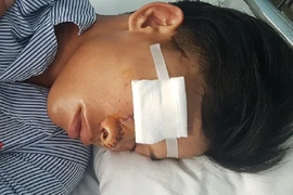 Bị chém trọng thương vì 'hỗn' với đàn anh