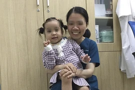 Khối u quái hỗn hợp vùng mặt bé gái 4 tuổi