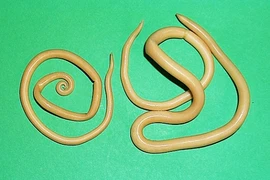 Cứu sống bệnh nhi bị giun đũa đục thủng ruột thừa