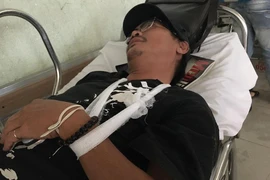 Vụ đạo diễn Đặng Quốc Việt: Hít thụ động cần sa có dương tính?