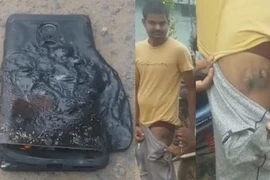 Smartphone và tai nghe bất ngờ phát nổ 