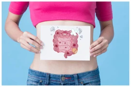 Căng thẳng gia tăng do sức khỏe đường ruột kém