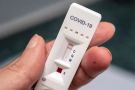 Bộ Y tế nói về kit test xét nghiệm SARS-CoV-2 khan hiếm