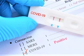 Bộ Y tế yêu cầu công khai niêm yết giá kit test COVID-19