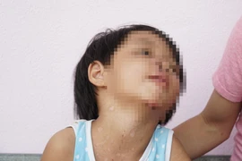 Xử nghiêm vụ bé gái 4 tuổi bị cha dượng bạo hành 