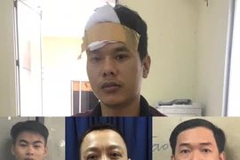 Nhóm buôn ma túy bắt người để đòi gói ‘hàng’ 1,3 tỉ đồng