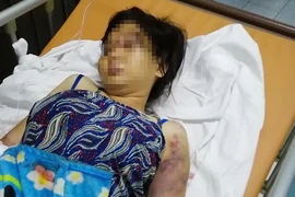 Phẫn nộ: 22 ngày cô gái bị tra tấn dã man, dẫn đến sẩy thai