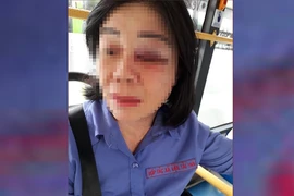 Nữ tiếp viên bị đánh bầm mắt vì nhắc khách mở nhạc nhỏ