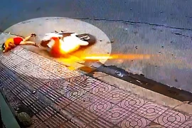 Cướp giật túi xách khiến người phụ nữ té ngã, nhập viện cấp cứu