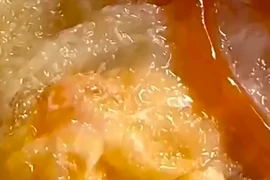 Người đàn ông hốt hoảng khi ăn hộp xôi có dòi bò lúc nhúc