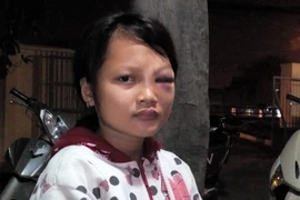 Đánh bé gái bằng nón bảo hiểm vì nghi trộm tiền