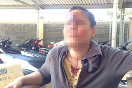 Một phụ nữ bị nhóm thanh niên đánh trọng thương