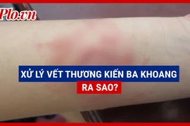 Video: Làm gì sau khi dính nọc kiến ba khoang?