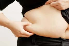 Người béo phì tăng biến chứng khi nhiễm COVID-19