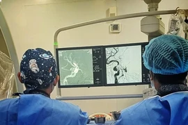 Ù tai đỏ mắt suốt 3 tháng, không ngờ bị rò động mạch cảnh