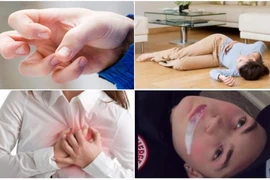 Bệnh động kinh có chữa được không hay phải sống chung suốt đời?