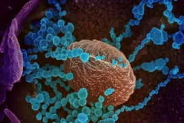 Hình ảnh kính hiển vi của virus SARS-CoV-2 nổi lên từ bề mặt của tế bào được nuôi cấy trong phòng thí nghiệm.