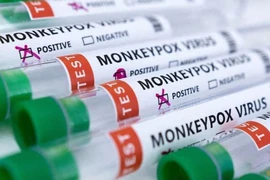 Các ống nghiệm có dán nhãn "âm tính và dương tính với virus đậu mùa khỉ".