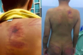 Clip: Đoạn ghi âm Người tu hành đánh trẻ em xin gỡ bài