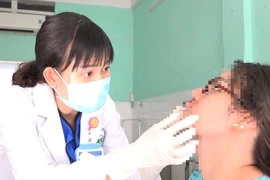 Tiêm filler làm đầy rãnh má, một người bị biến chứng mưng mủ