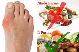 Bị gout, kiêng cữ ăn uống trong ngày Tết ra sao?