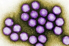 Tám ca nhiễm virus Adeno ở Bình Thuận là do lỗi của người… đánh máy!