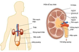 Người bệnh sẽ được lọc thận nhân tạo tại trạm y tế