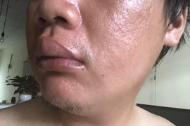 1 nhà báo bị đánh ở quận 9