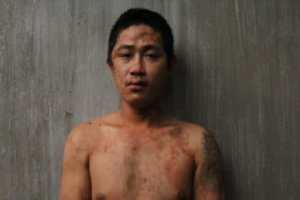 Bắt giam người say dùng mảnh kính tấn công công an TP Thủ Đức