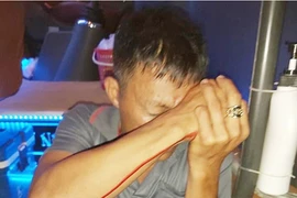 Một phụ xe bị bắn trọng thương ngay tại bến ở Quy Nhơn 