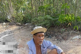 Xe ben cán 2 bàn chân cụ ông rồi bỏ chạy