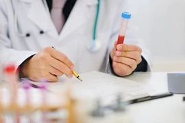 Kỹ thuật lọc máu hiện đại giúp chữa nhiều bệnh hiểm nghèo