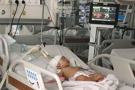 Mối nguy từ thú nuôi cưng là động vật hoang dã