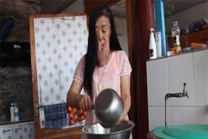 Cuộc sống khổ hạnh của những người mắc bệnh lạ