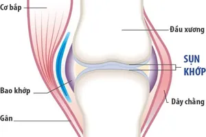 Thoái hóa khớp hay viêm khớp dạng thấp?