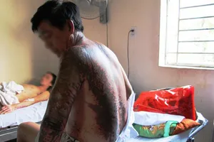 Đang đi tập thể dục, 4 người bị tạt axít 