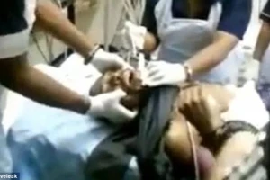 Cứu sống một nạn nhân nuốt smartphone 