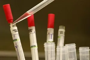 Cổ phiếu của các công ty sản xuất thuốc chữa Ebola tăng mạnh