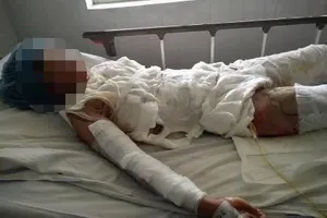 Chị Khê, nạn nhân bị chồng đốt đã tử vong