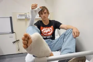 Mất ngón tay, đành thay thế bằng ... ngón chân