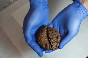 45 bộ não còn nguyên hình thù sau 80 năm chôn vùi